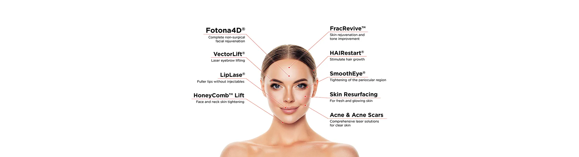Fotona Aesthetic Lasers test